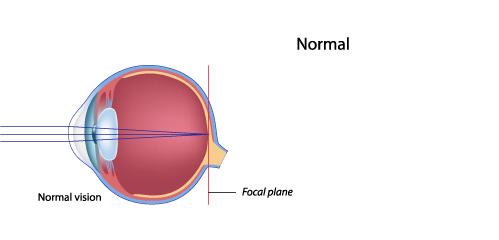 illustration_normal-vision